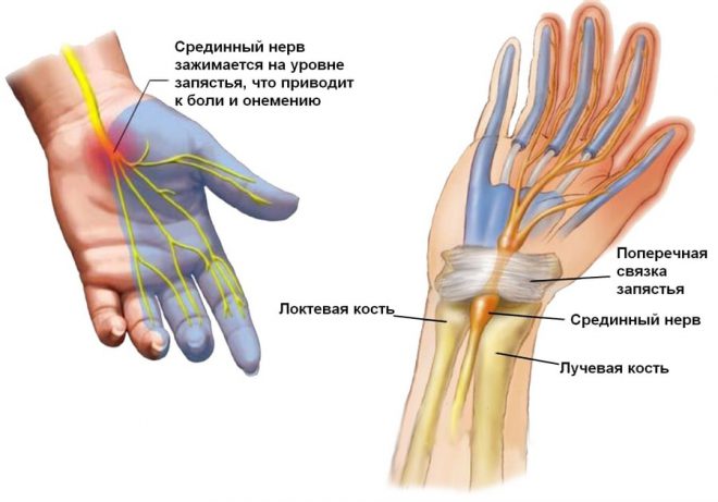 durere în articulația degetului arătător al mâinii drepte)