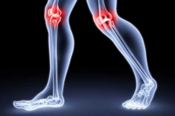 consecințe ale inflamației genunchiului)